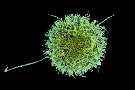 Micograph of a natural killer cell, a fuzzy sphere with a few long, spindly protrusions