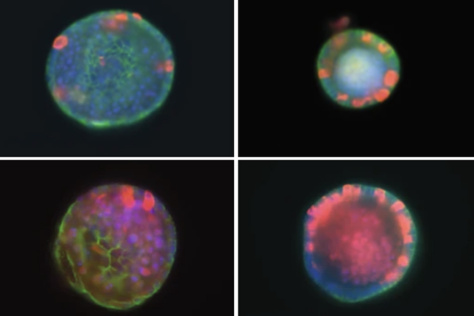 4 organoids showing different patterns of fluorescent staining