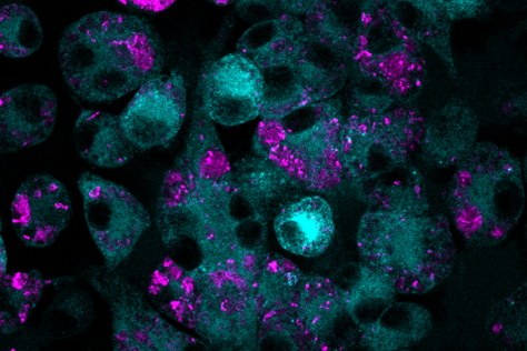 confocal microscopy image showing round macrophages treated with MTX (cyan) that have eaten bacteria (magenta)