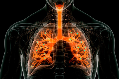 illustration of a trachea and lung in orange, against a dark silhouette of a person