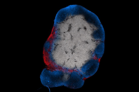 a lymph node with an outer ring of red and blue, indicating the presence of T and B cells respectively