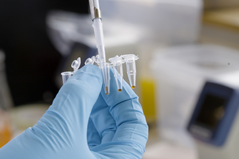 A gloved hand holds a row of small plastic tubes, with a pipette inserted into one of them
