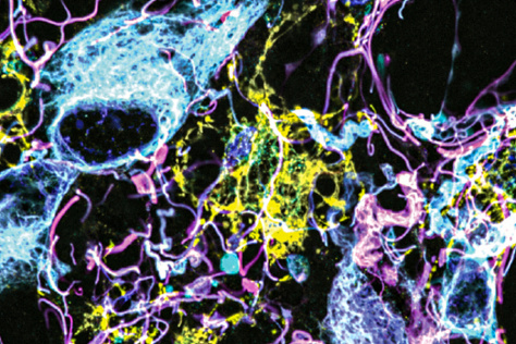 colorful, squiggly brain tissue on a black background