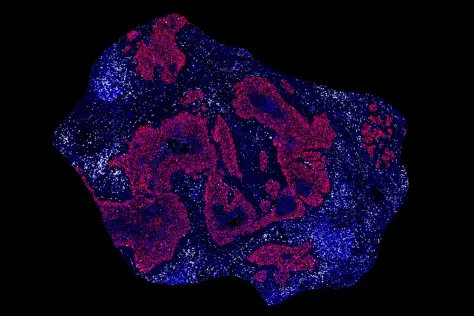 Scientific image featuring blue and purple splotches