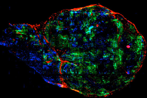 An image showing poor distribution of an antibody through a tumor grown in a mouse.  