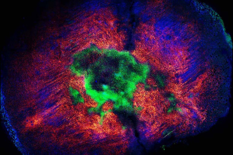 immune cell - green, red, blue and purple blobs on a background 