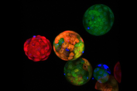 A 3D image of developing cells, with different colors represent different activation states of an epigenetic process—DNA methylation—that suppresses gene activity.