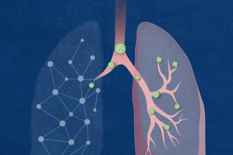 Pink and green illustration of lipid nanoparticles against a blue background - the there is text that says Nature Biotechnology on top and the bottom has text that reads Lung delivery using AI-designed lipid nanoparticles