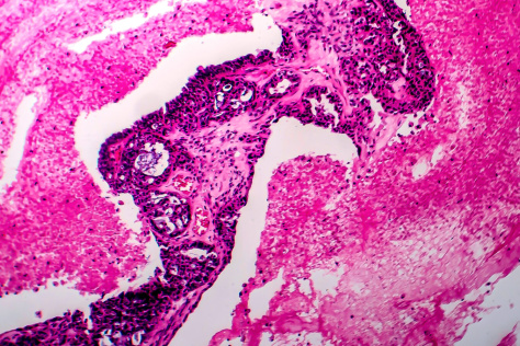 Colorful scientific image with a pink swirl pattern