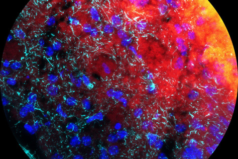 cloudy swirls of black, red, and yellow, overlaid with blots of royal blue a network of delicate cyan strands