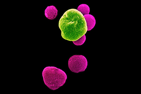 an image of a cell with a green and yellow cell