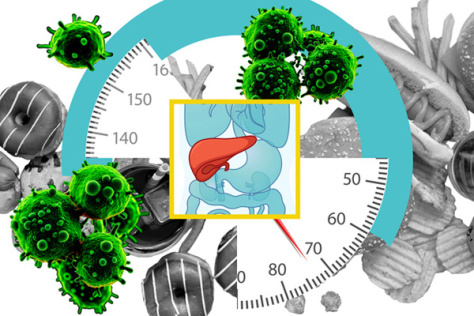 High-fat foods, sections of a bathroom scale, and cancer cells around an image of a liver.