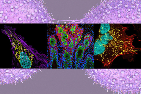 Three screens of cancer cells