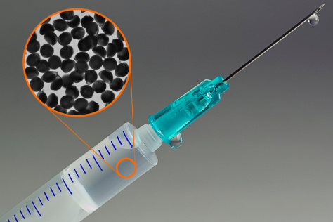 A syringe full of microparticles (A new way to deliver antibodies could make treatment much easier for patients) 