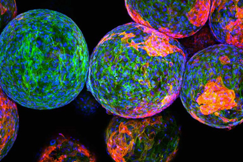 Brightly colored, close-up view of cells in spherical clusters. They glow in vibrant greens, blues, and reds, creating a dynamic and lively visual effect.