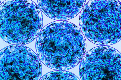 Microscopic view of clustered, round, translucent blue cells with swirling patterns and dark speckling, organized in a grid.