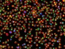 yeast cells stained with fluorescent proteins to show DNA damage