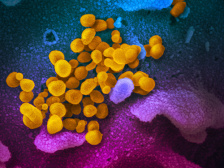 micrograph of coronavirus colored in gold, pink, and blue
