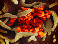 micrograph of coronavirus colored in orange and gold