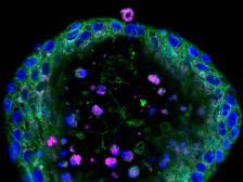 nanoparticles (small magenta dots) inside a blue and green sphere of cancer cells.