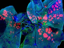 Fluorescence image of lung tissue in blue and green with bright patches of pink nanoparticles