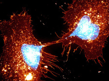 two cells, with bright blue nuclei and copper-colored cell bodies, dividing
