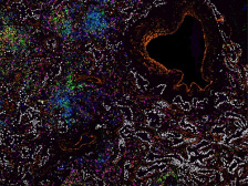 Tiny, multicolored cells swirl around a reddish, heart-shaped hole