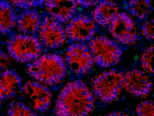 intestinal epithelium cells stained for their ability to generate primary cilia